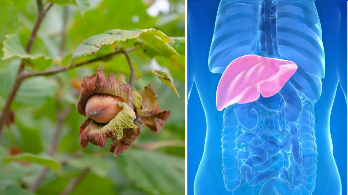 scoperto il potenziale antitumorale della nocciola