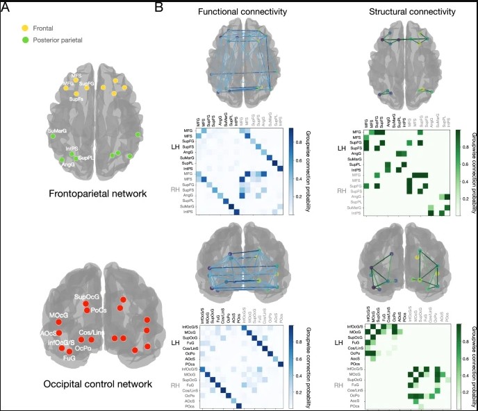 Le basi della musicalità nella connessione delle reti cerebrali